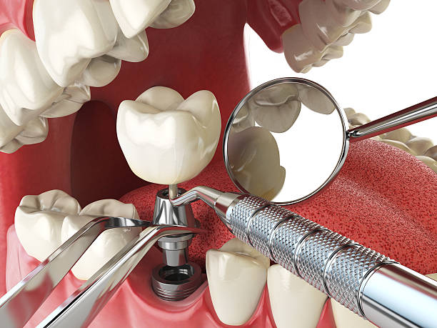 Best 24-Hour Emergency Dentist in Laurinburg, NC