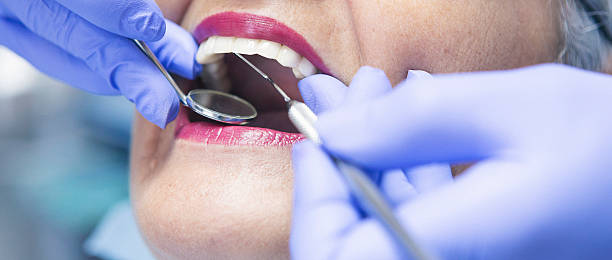 Best Emergency Broken Tooth Repair in Laurinburg, NC